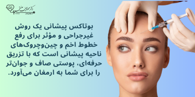 بوتاکس پیشانی و رفع خط اخم