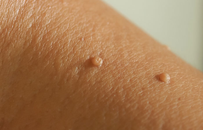 برداشتن اسکین تگ