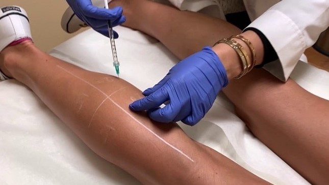 فیلر بادی ساق پا و ران