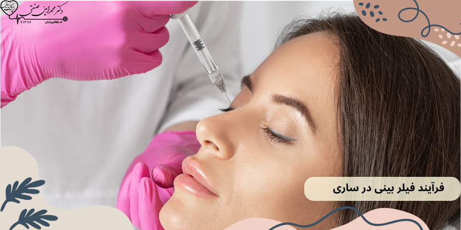 فرآیند فیلر بینی در ساری