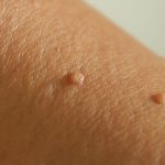 برداشتن اسکین تگ