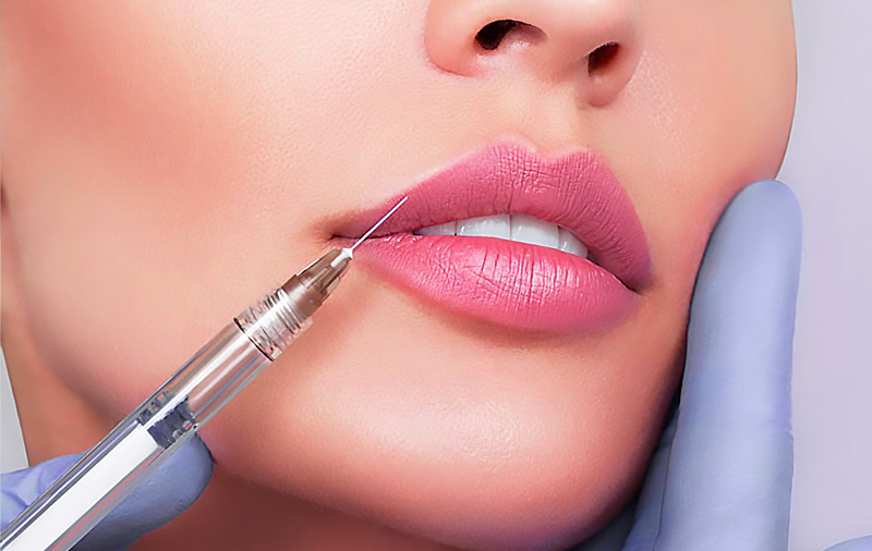 تزریق فیلر لب