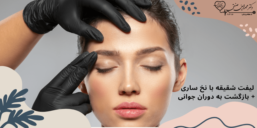 لیفت شقیقه با نخ ساری