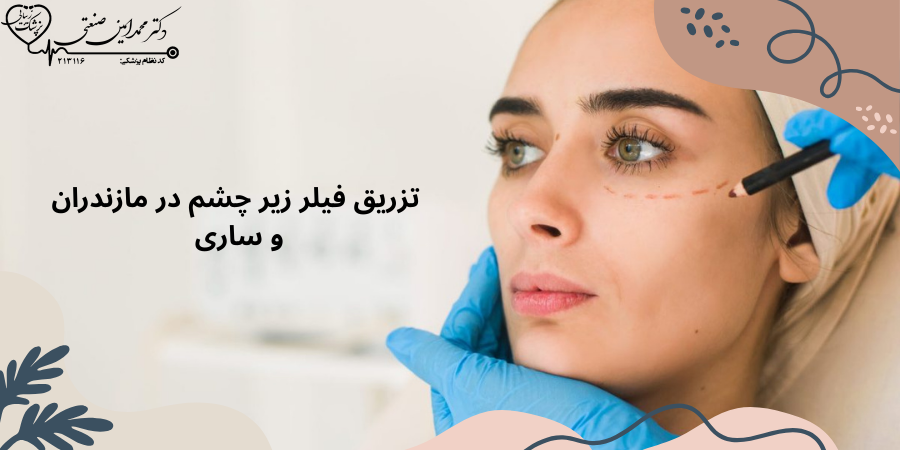 تزریق فیلر زیر چشم در مازندران و ساری